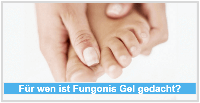 Fuß mit Nagelpilz abgebildet. Fungonis Gel Anwender