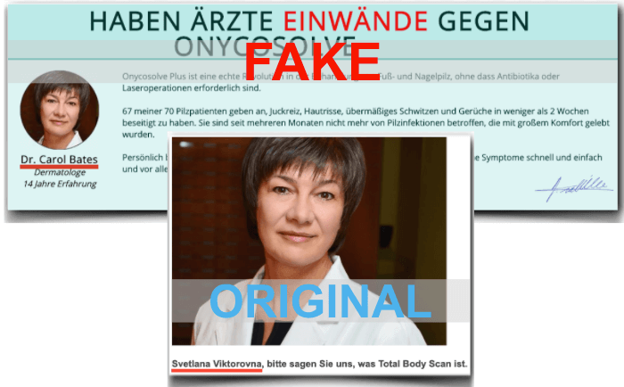 Fake Erfahrungsbericht und original Foto zu sehen Onycosolve Fake Arzt