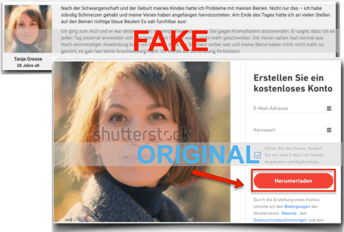 Fake Erfahrungsbericht und original Foto zu sehen Varikosette Fake Erfahrungen Bewertungen