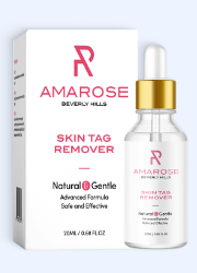 Amarose Skin Tag Remover Image Blue Amarose Skin Tag Remover Image Blue