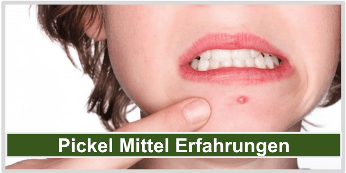 Eine Frau mit einem Pickel unter der Lippe Pickel Mittel Erfahrungen Bild