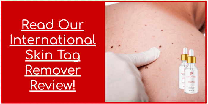 Read Our International Skind Tag Remover Review Read Our International Skind Tag Remover Review